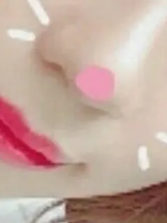 みなみ(パイナップル)