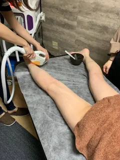 光脱毛無料